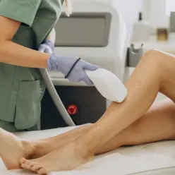 Mulher realizando depilação a laser na perna em uma clínica de estética para remoção permanente de pelos e pele mais lisa